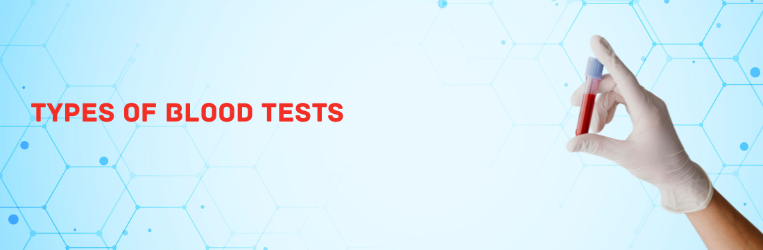  Different Types of Blood Tests